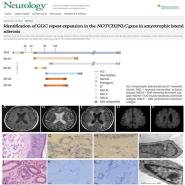 ҽԺŶ Neurologyٴоԭɹ