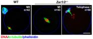 ʵNucleic Acids ResearchZAR1ZAR2ĸϸжĸԴת¼ȶԺmRNA뼤ĵڻ